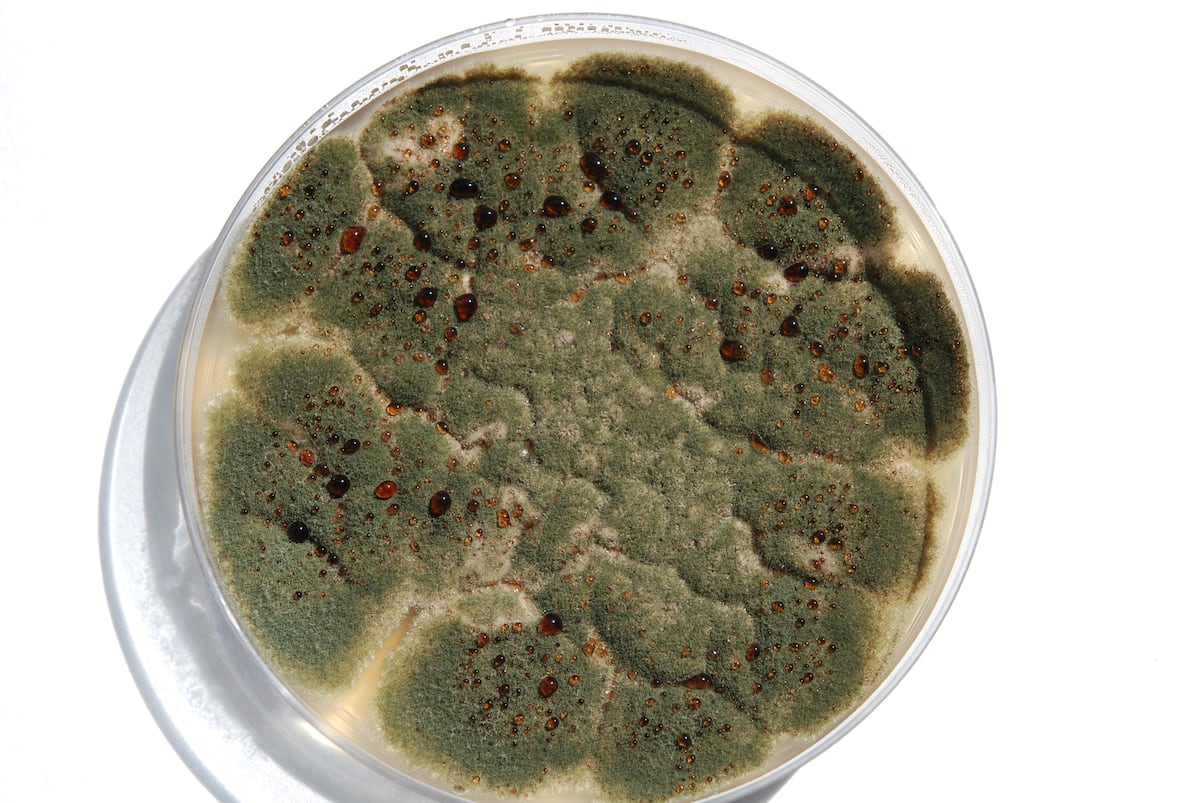 Qué es el ‘Aspergillus’, el hongo contagioso que obligó a cerrar cinco pabellones de un hospital público en Chile