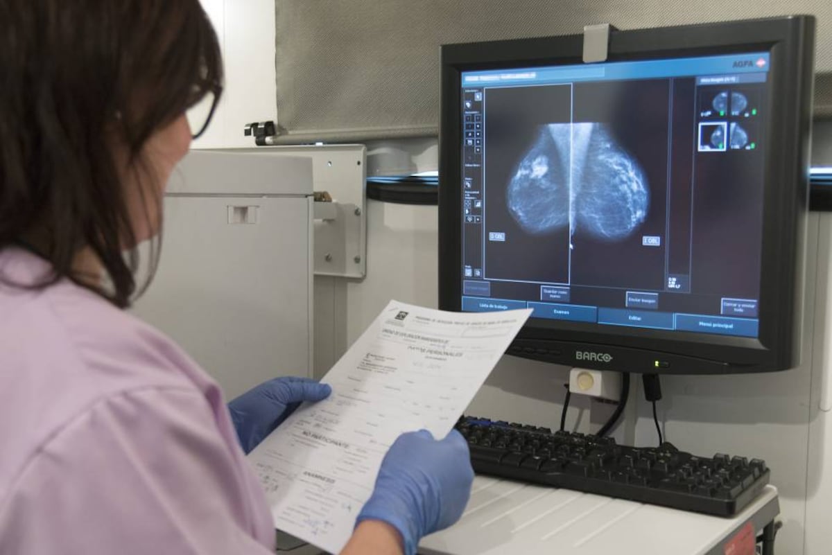 Un ensayo pionero alumbra alternativas de detección precoz del cáncer de mama cuando la mamografía se hace insuficiente | Salud y bienestar